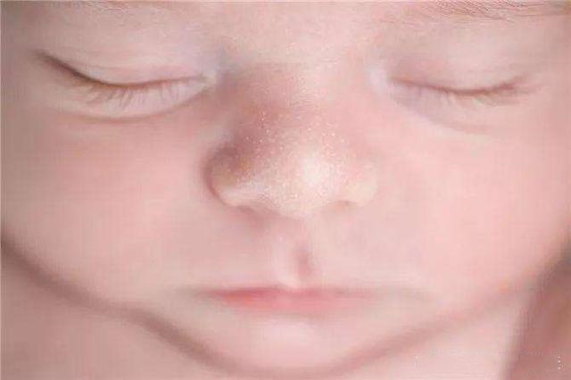 害怕宝宝睡觉受惊?看完后家长再也不用担心宝宝的这几种生理现象