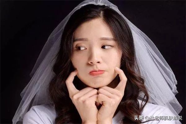 祛褐斑效果最好的方法,祛褐斑最好方法