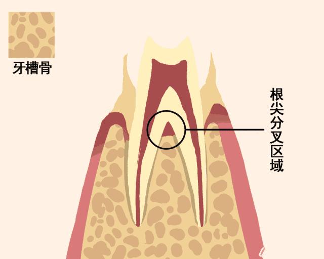 牙齿摔松动怎么办,牙齿松动恢复秘方