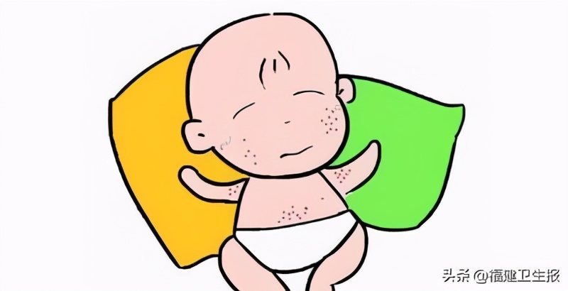 儿童泡过药浴全身像过敏一样,1岁宝宝泡药浴起疹子