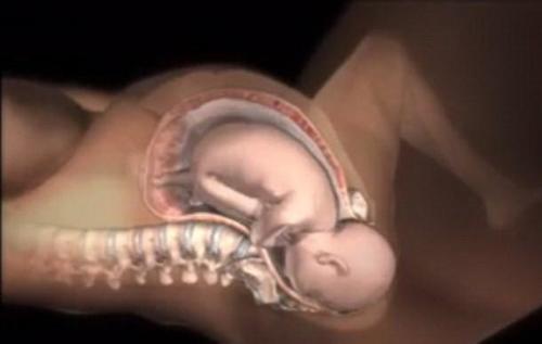 产道那么小怎么顺产,产道那么小胎儿怎么出来的