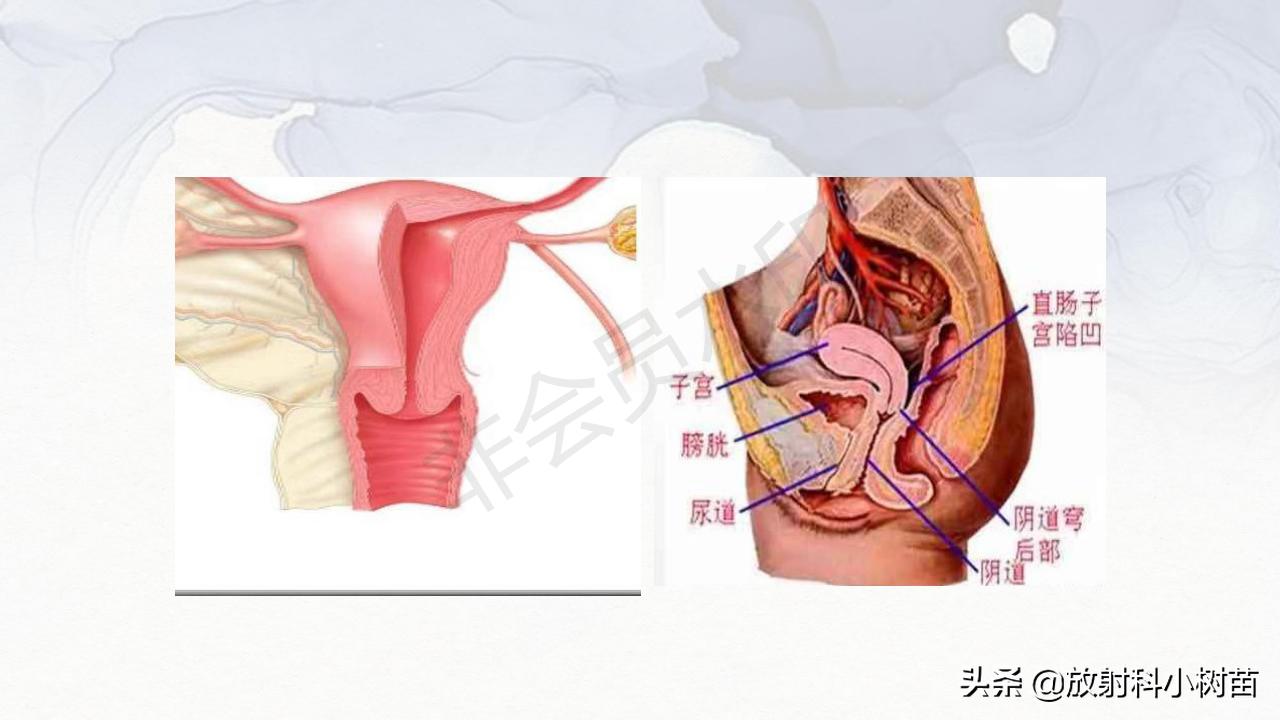 女性盆腔mri解剖图谱,泌尿生殖系统x线解剖