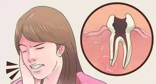 大晚上牙痛的睡不着怎么缓解,牙痛出血晚上痛的睡不着