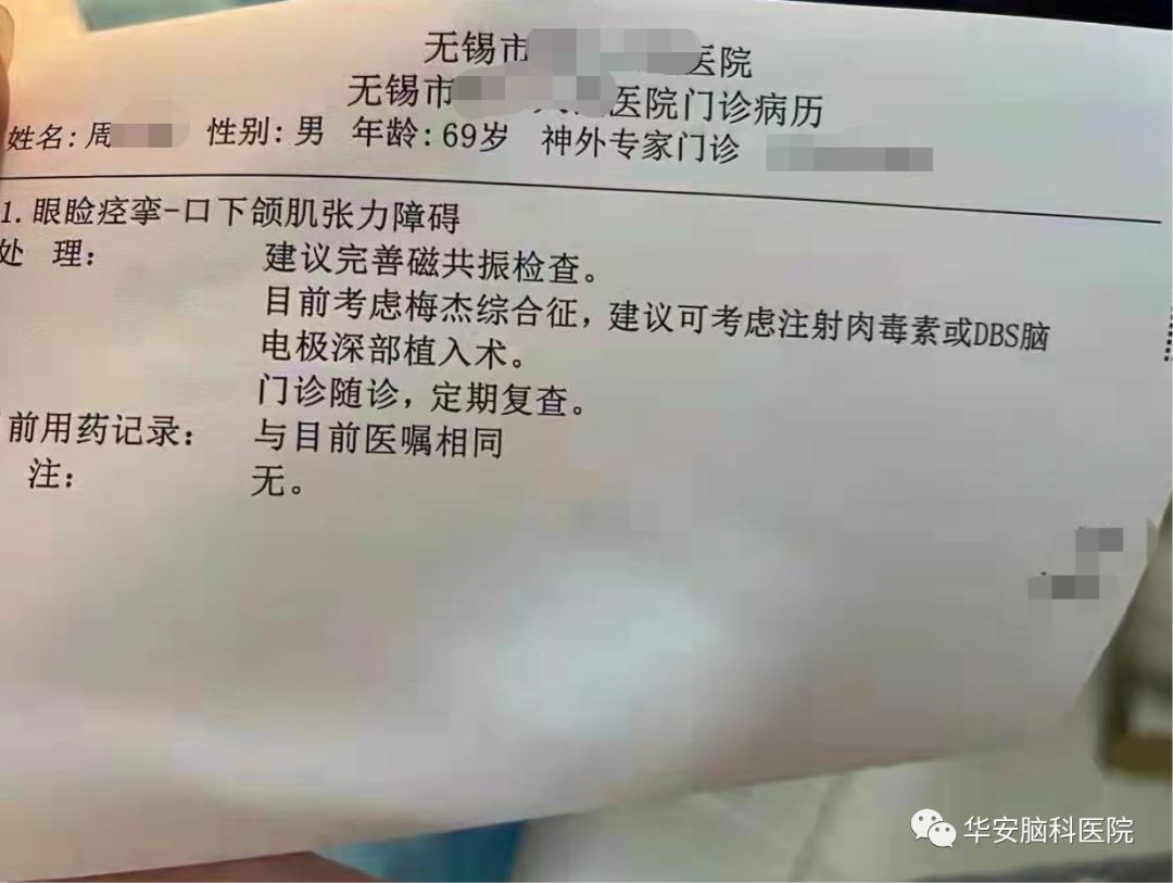 梅杰氏综合征dbs手术成功率,梅杰综合征微创手术打几个孔