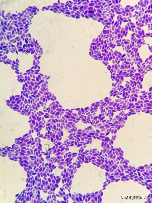 美国发现罕见真菌感染病例,感染100天后死亡率