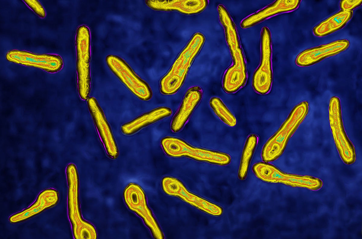 人类破伤风,人类怕破伤风吗