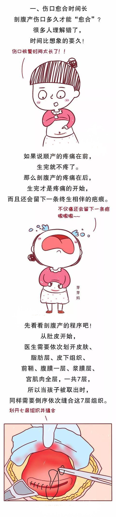 剖腹产伤口大概多久可以全部愈合,剖腹产一个月伤口愈合处肿还是痛