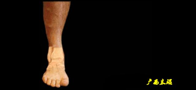 为什么踝关节扭伤容易崴脚,崴到脚踝关节扭伤怎么处理好得快