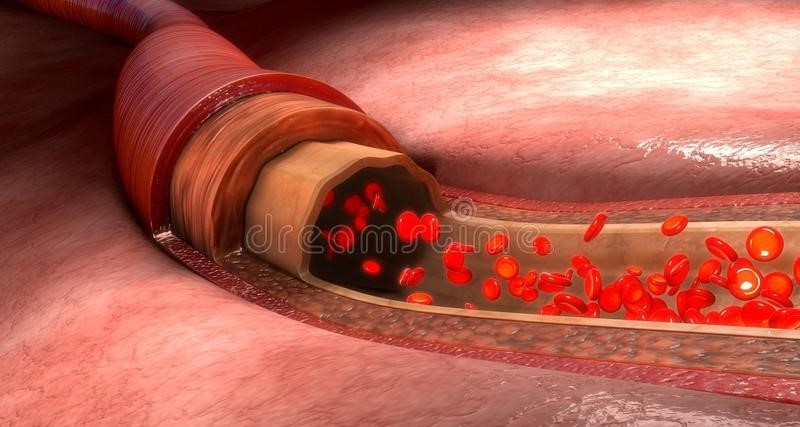 米诺地尔降压副作用,2%的米诺地尔治疗脱发有效吗