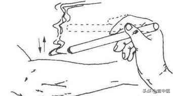 最全艾灸方法70余种请收藏,几种正规的艾灸手法视频教学