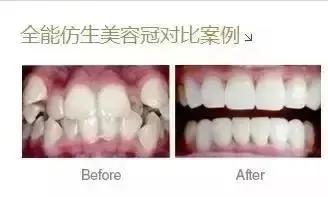 延禧攻略美容仪,延禧攻略给女人的忠告