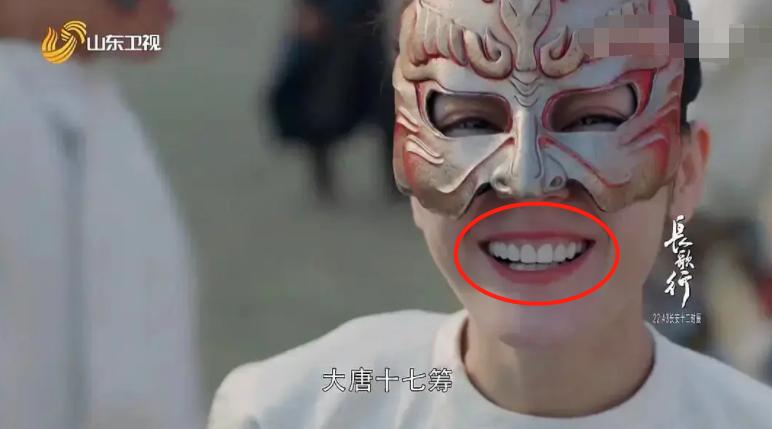 《长歌行》迪丽热巴咧嘴大笑，烤瓷牙“抢镜”忒显老