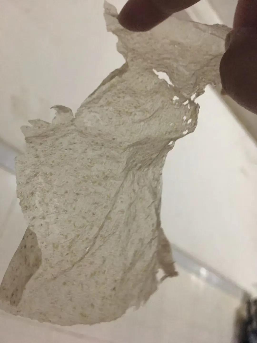 骨折人情冷暖,骨折后明白了人间冷暖