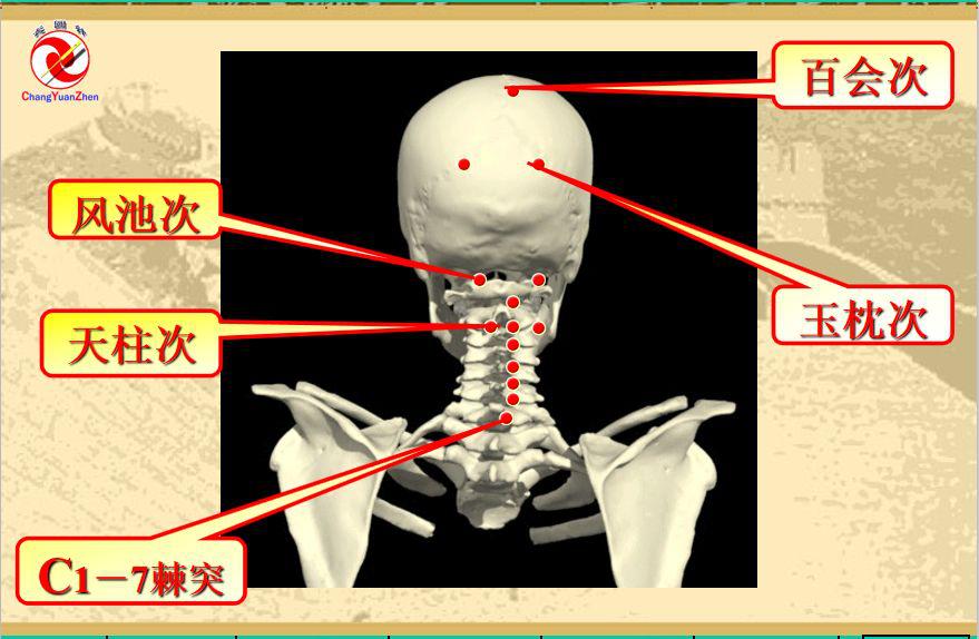 颈椎病的诊断及针灸治疗,长圆针可以治愈颈椎病吗
