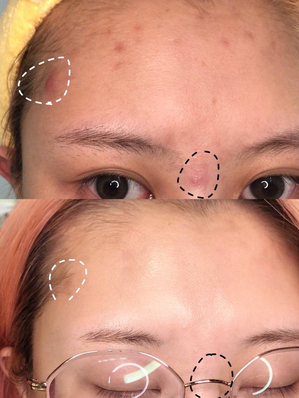 鍒濅腑绁涚棙鑽啅璇勬祴,鑰佺埜璇勬祴鑽啅绁涚棙