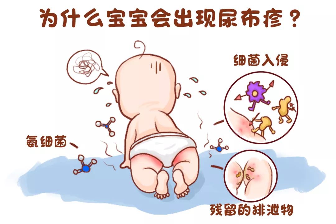 宝宝“红屁股”反反复复?别总让纸尿裤背锅,孕妈护理也有错