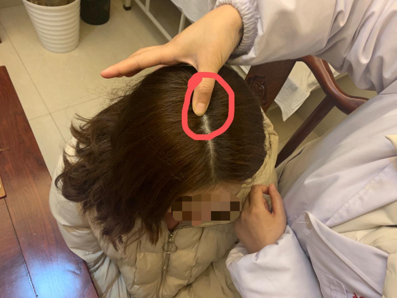 穴位按摩治失眠三个穴位助你入睡,失眠最快入睡方法按哪个穴位治疗