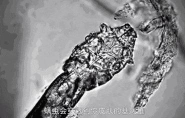 硫磺除螨止痒皂推荐,硫磺除螨皂排行第一名