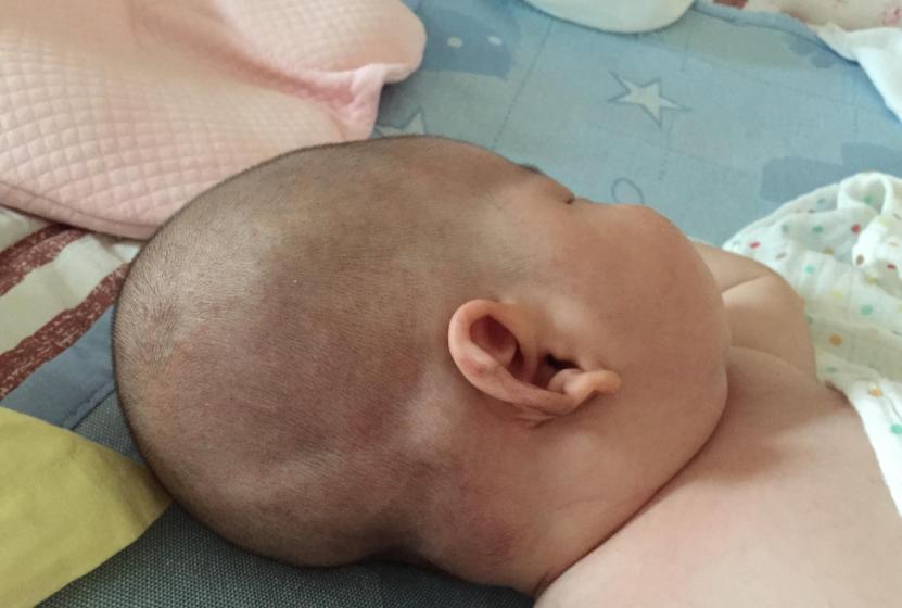 人类幼崽10月怀胎却还是早产,早产儿输在起跑线上