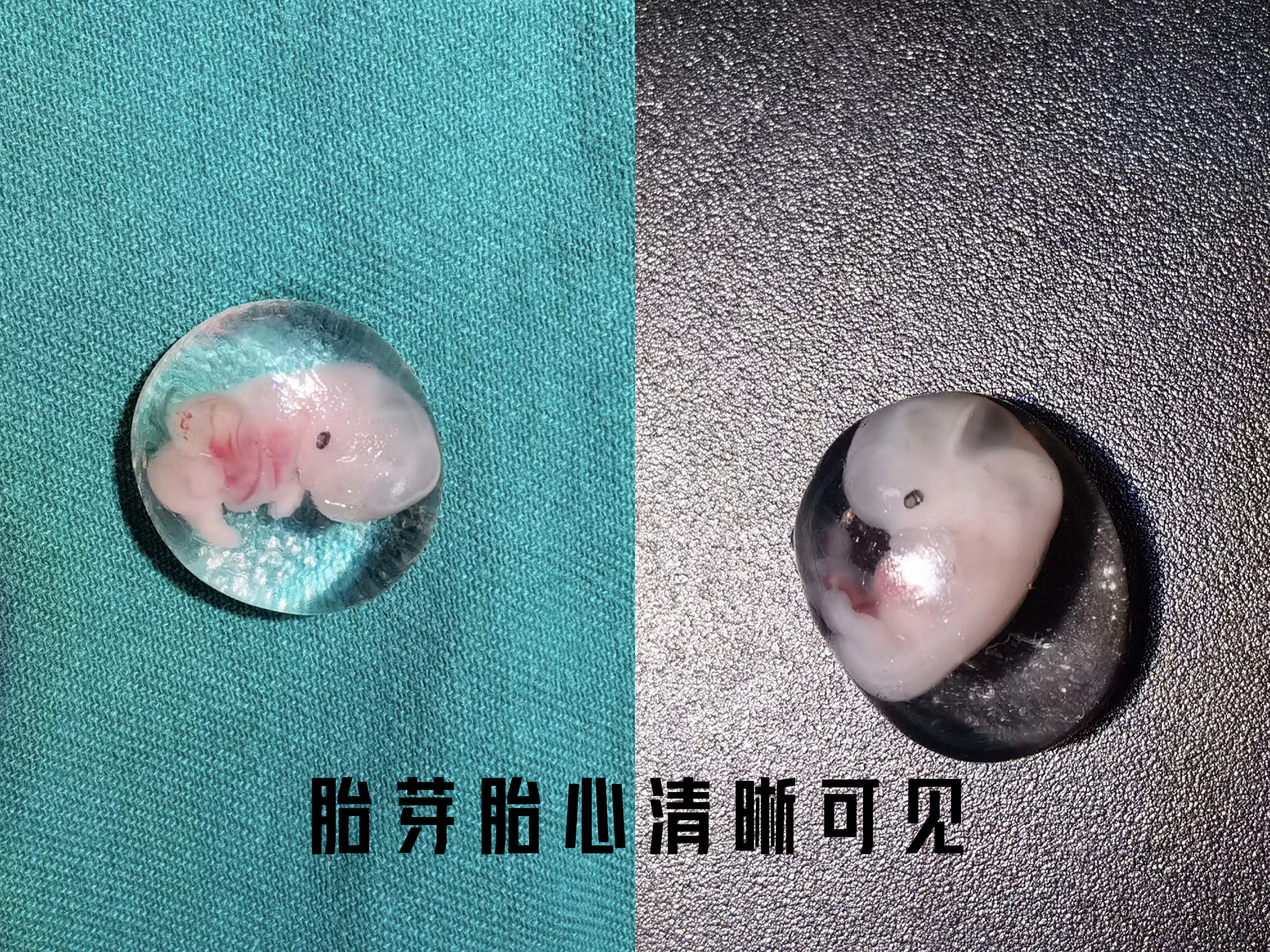 月经淋漓不尽突然大出血啥原因,来月经小腹疼得厉害是不是宫外孕