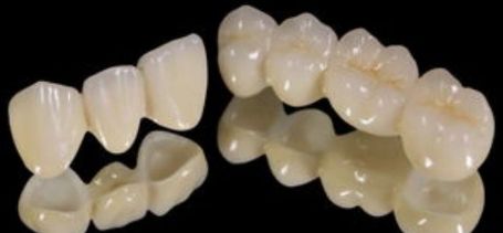 二氧化锆牙齿能做ct和核磁共振吗,氧化锆全锆牙冠能做核磁共振吗