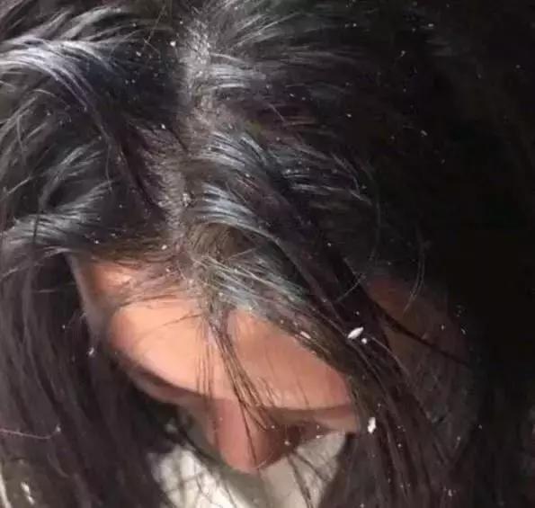 防脱的几种情况,防脱问题图