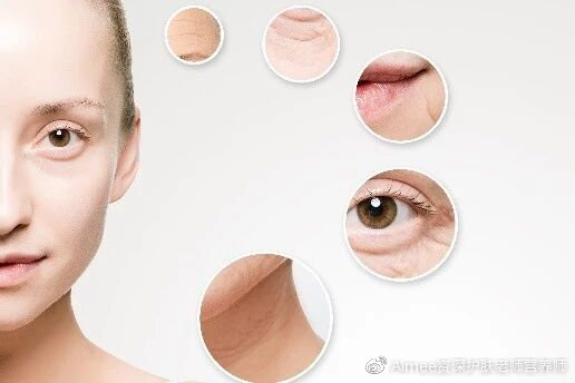 青春期黑头痘痘闭口毛孔粗大出油,油光满面毛孔粗大黑头闭口怎么办