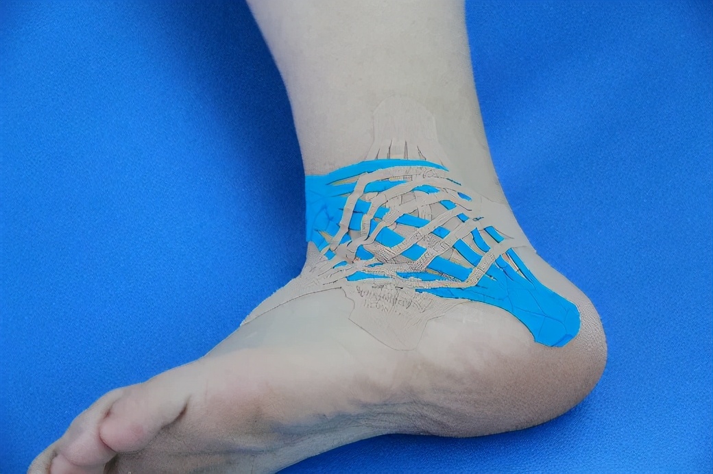 弹性贴布的原理,弹性贴布的作用