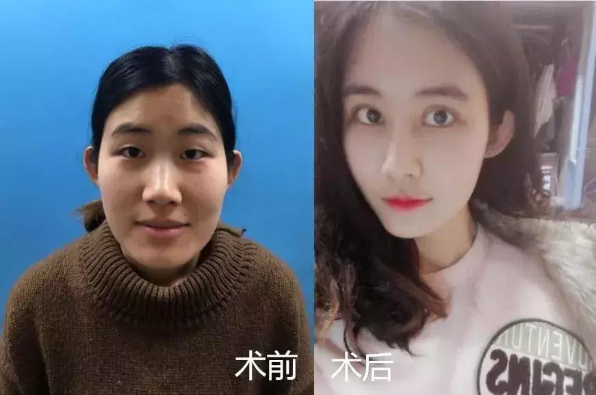 化妆真的能完全遮住瑕疵吗,化妆也掩盖不了岁月的痕迹