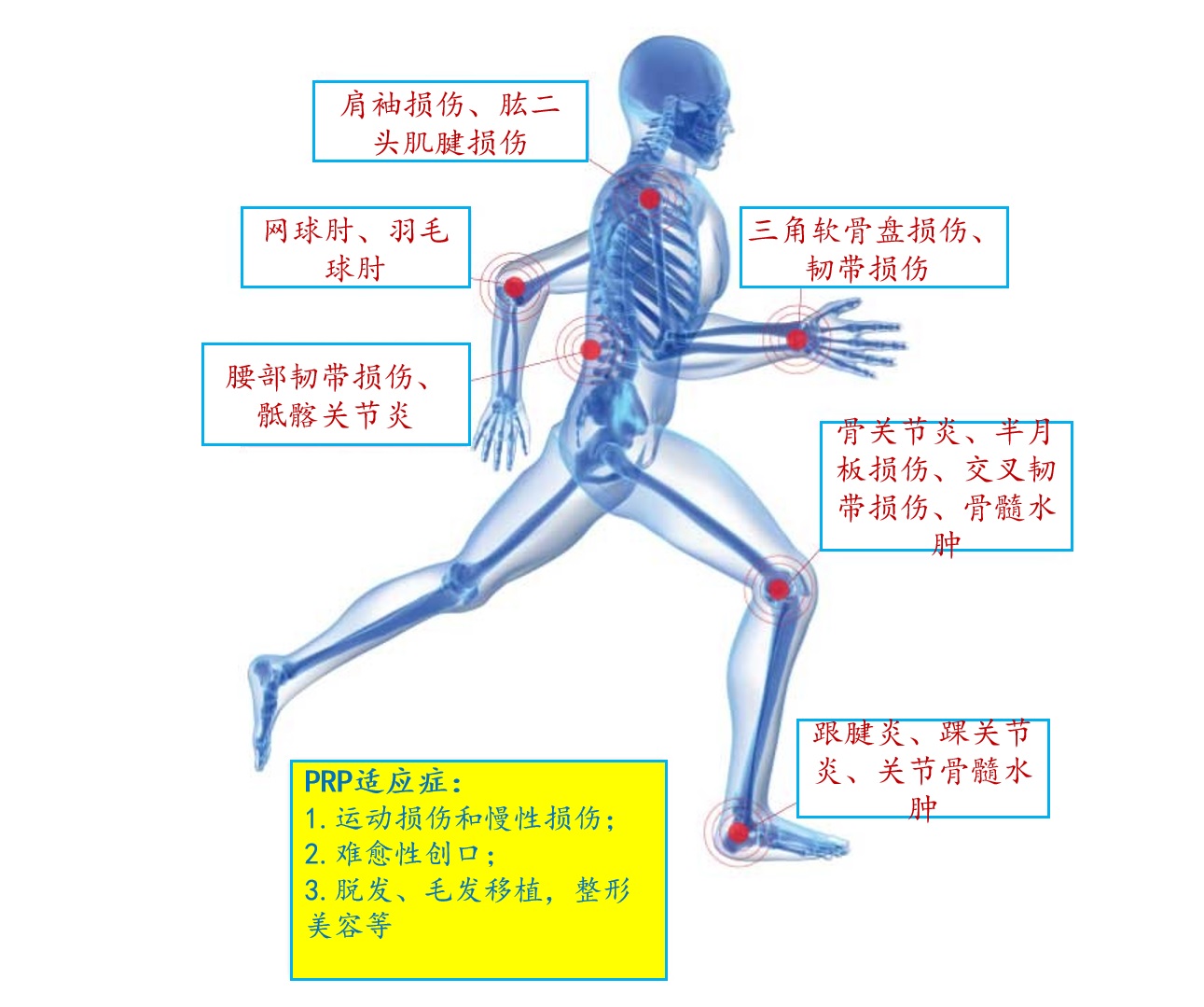 PRP治疗术——超级巨星也选择的的自体组织再生疗法