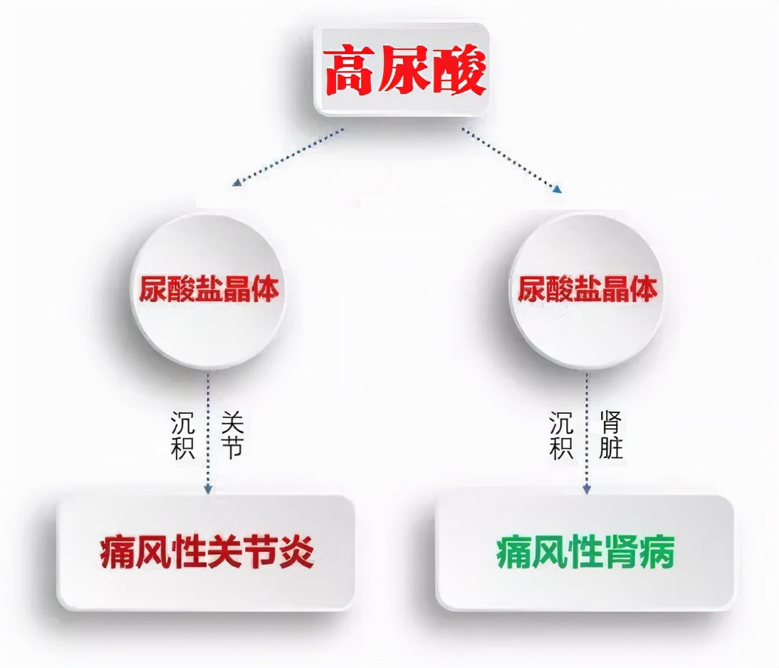 别嘌醇在痛风急性发作期能吃吗,别嘌醇痛风发作前吃吗