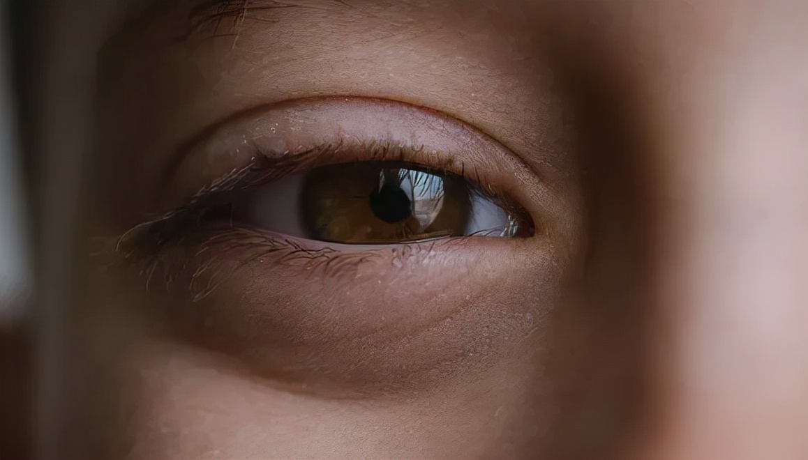 为什么压力大会产生黑眼圈,缺氧型黑眼圈产生原因