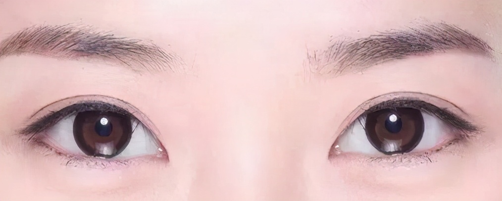 怎么判断自己适合什么双眼皮类型,如何了解自己适合哪种双眼皮类型