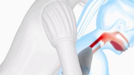 宝宝异物卡喉怎么办,异物卡喉海姆立克急救法多久有效