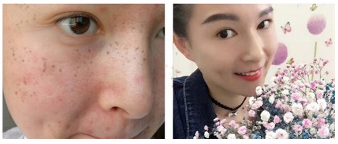 胶原蛋白如何补,胶原蛋白应该怎么补