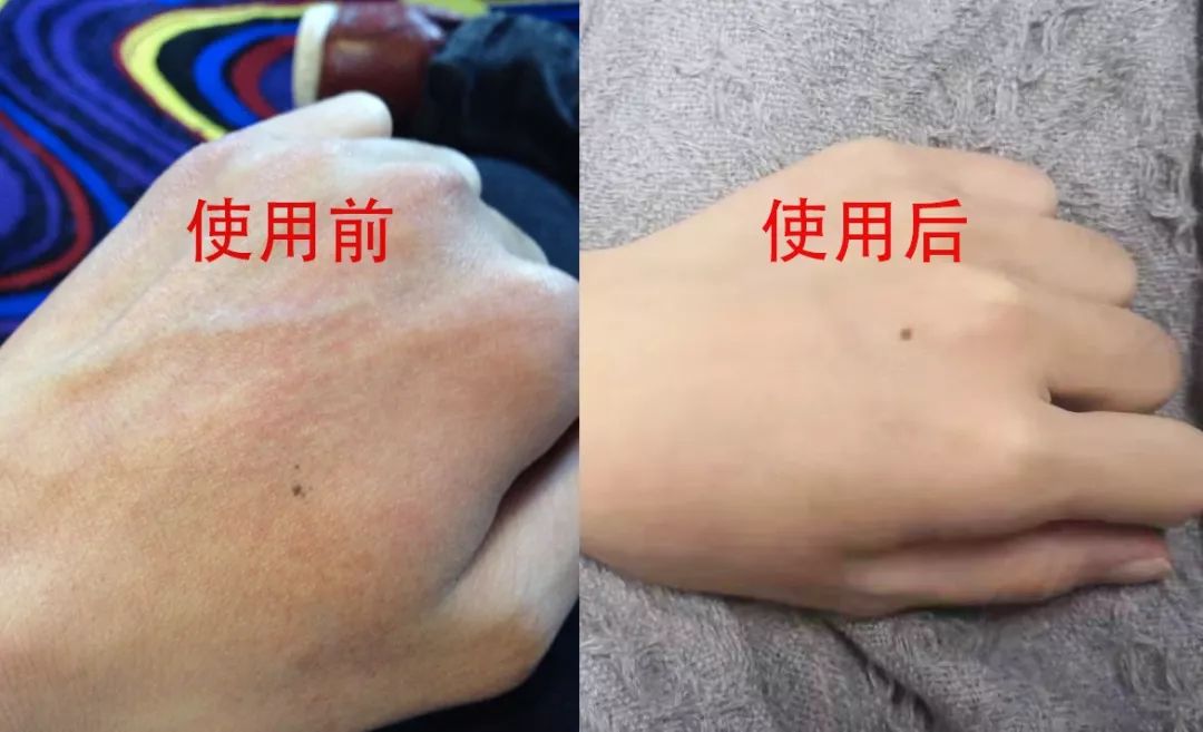 手干燥粗糙手纹深用什么护肤产品,可以改善手纹粗糙的护手霜