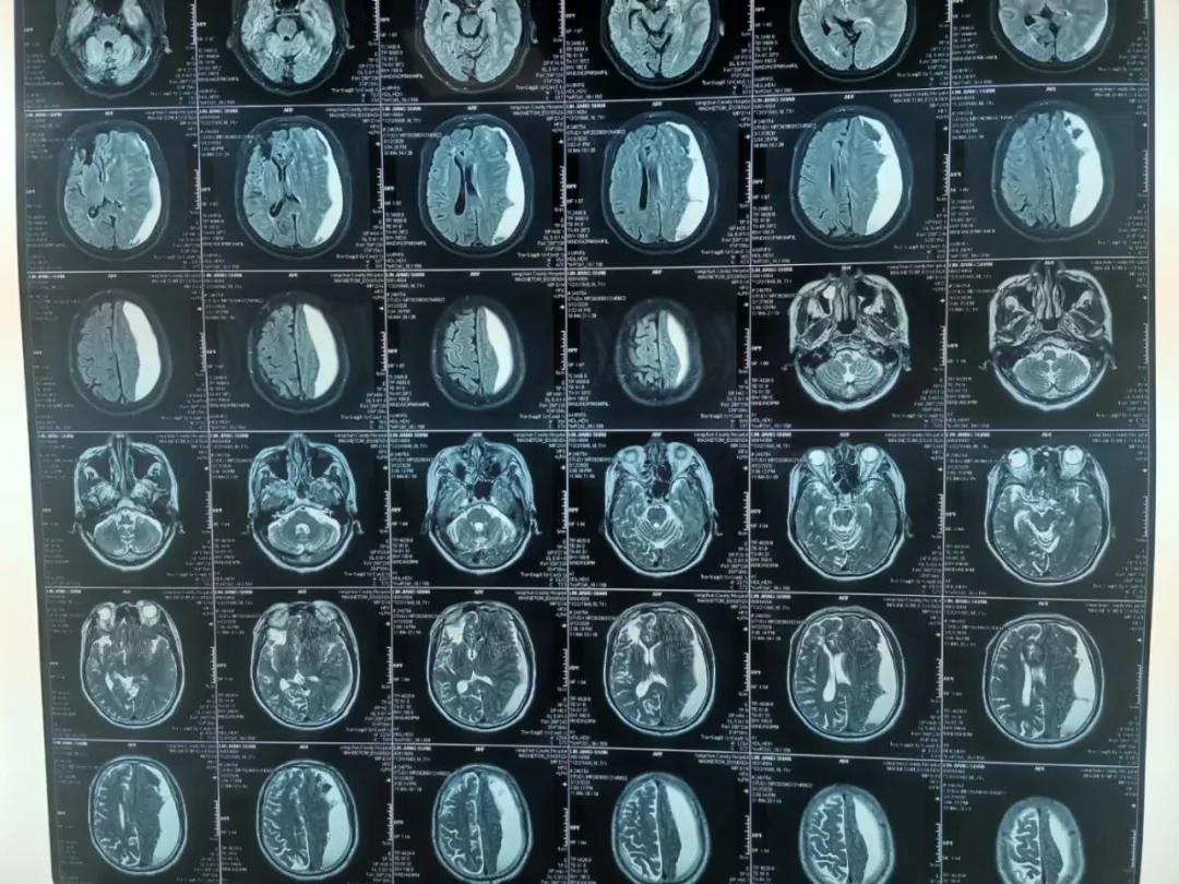 泉州:突破!永春县总医院成功开展新技术