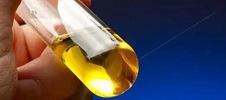 尿液白细胞160多严重吗,尿里白细胞115说明哪里有病