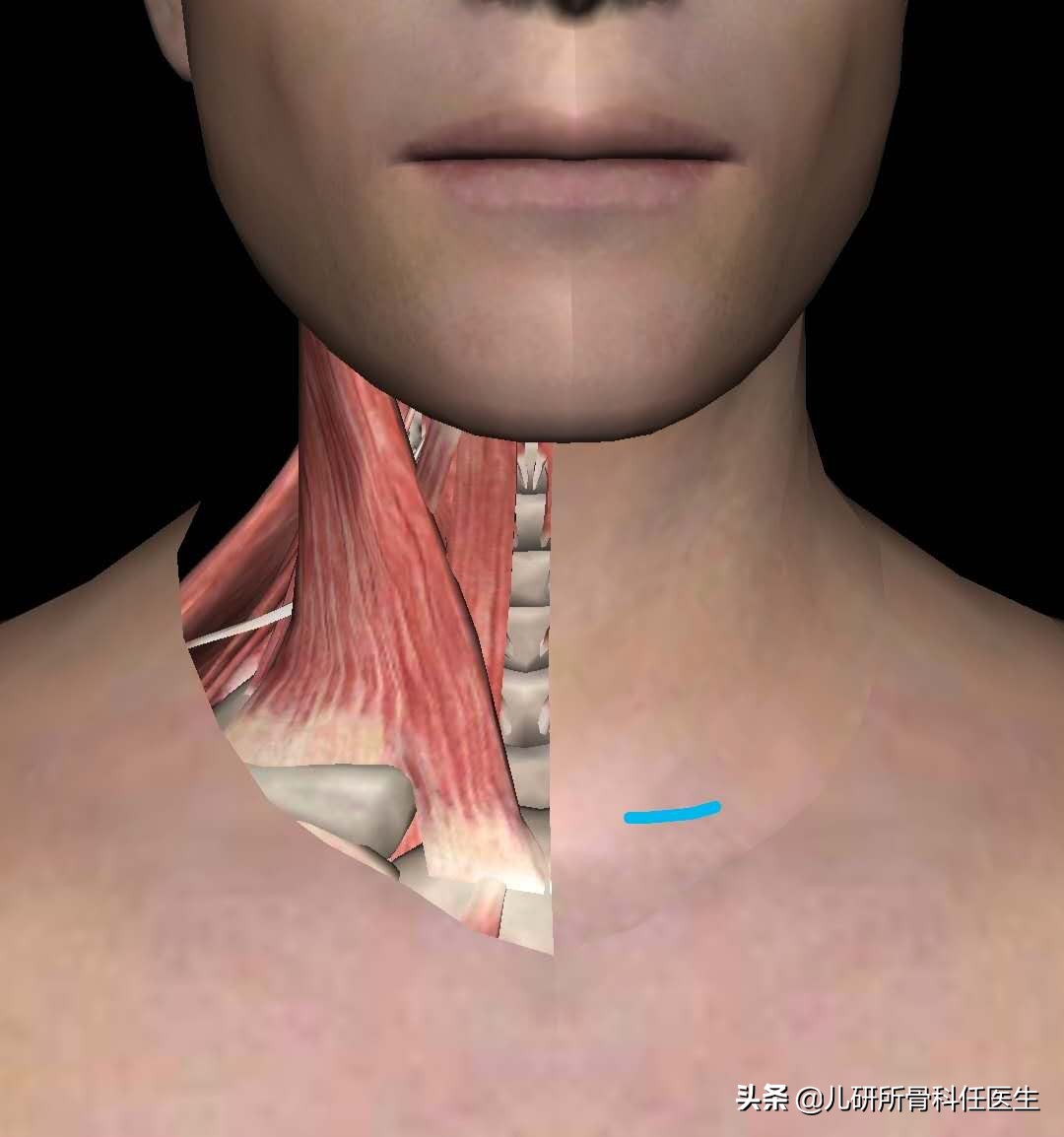 宝宝斜颈的康复治疗及训练方法,6个月宝宝肌性斜颈怎么办
