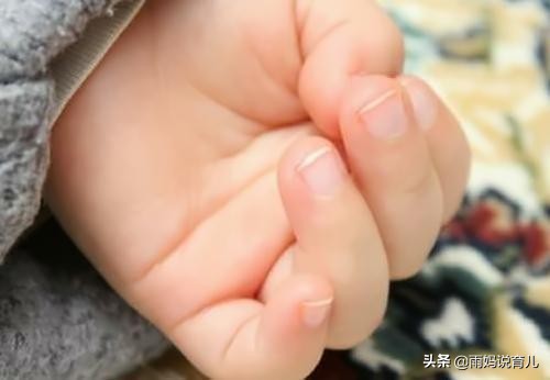 指甲白色缺钙,指甲盖上有白点是有蛔虫的意思吗