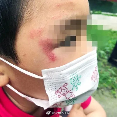 遇到这些虫子千万别拍它,提高警惕遇到这些虫子千万别乱拍