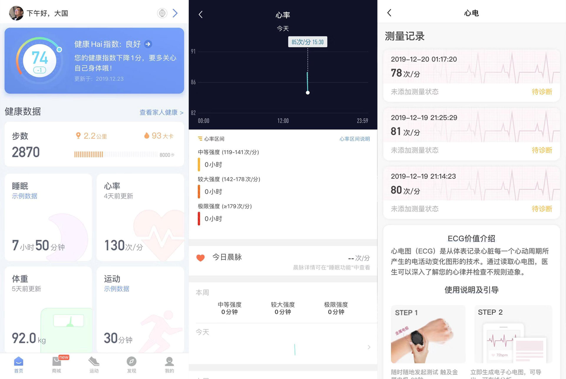 乐普心电手表使用体验,心电监测的智能手表