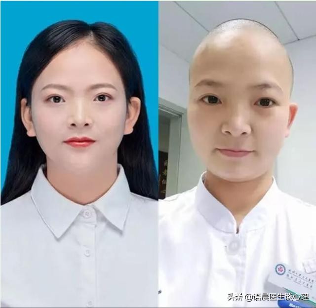 女医生剃光头原因,女护士剃光头热议