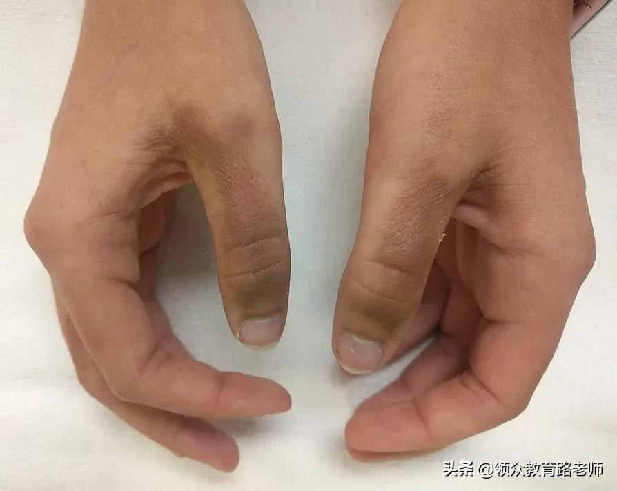 为了写文章我吃了霉苋菜梗,打算申请个工伤