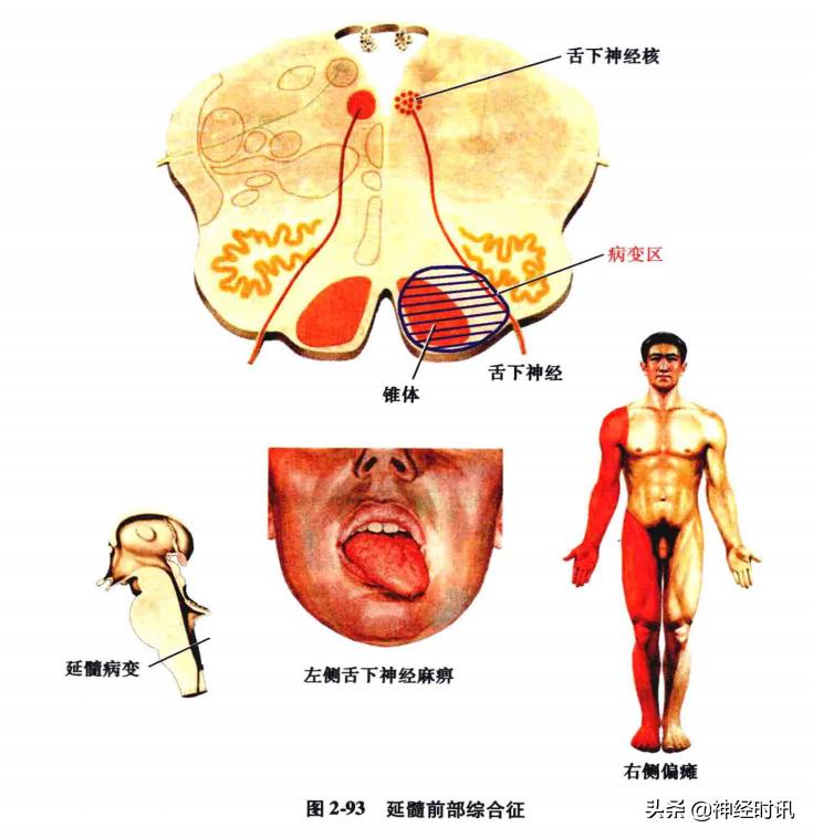 脑干解剖,脑干神经解剖