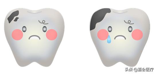 宝宝不怎么吃糖怎么还长蛀牙,不给孩子吃糖为什么还有蛀牙