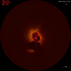 oct在冠脉介入的应用,广西冠脉介入治疗
