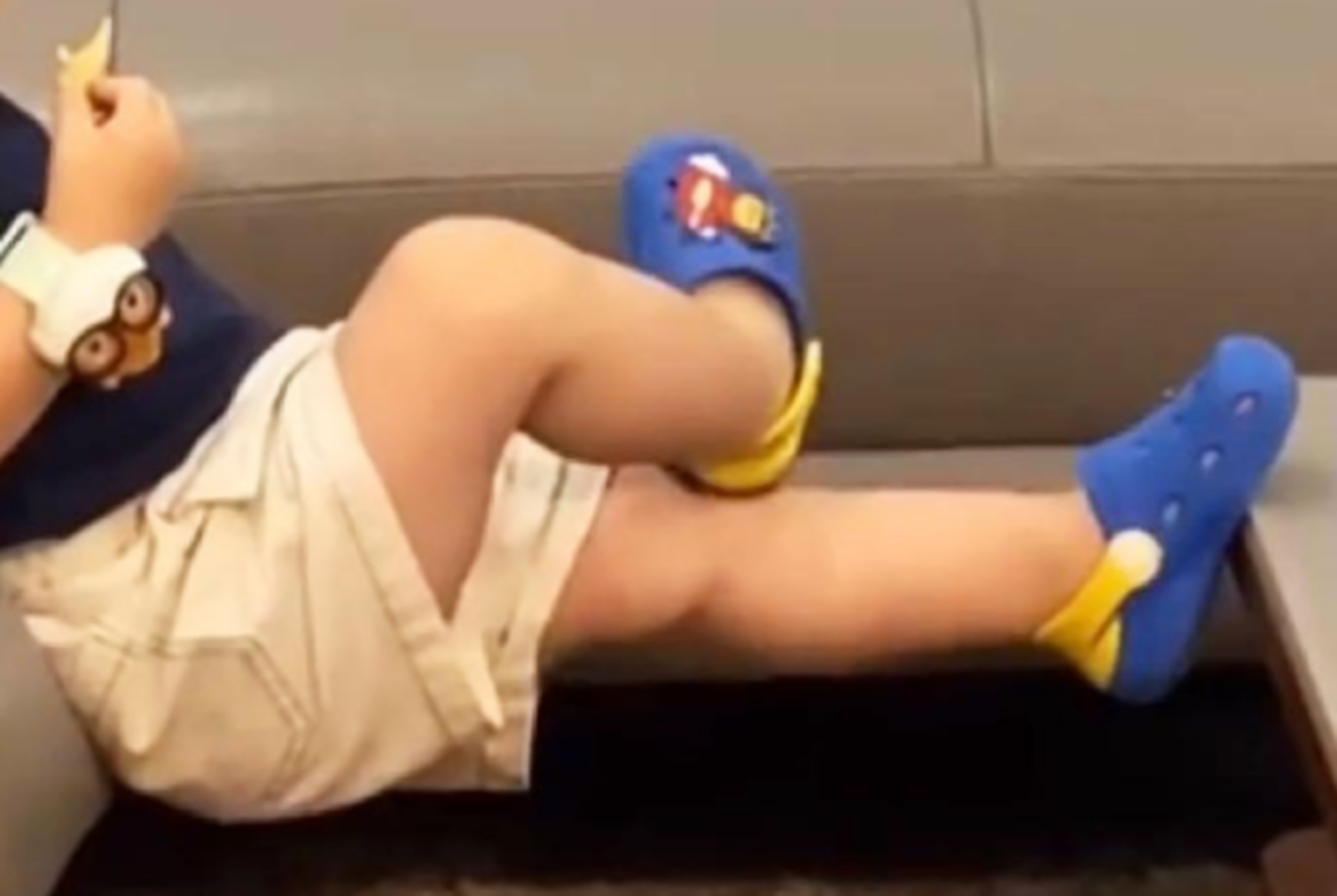 导致孩子罗圈腿的原因,小孩为什么小时候都有点罗圈腿