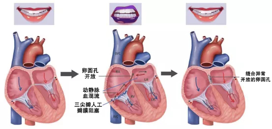 嘴唇发紫被抢救,嘴唇慢慢变紫是什么原因