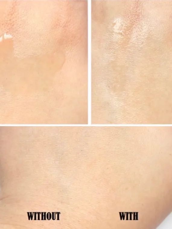 祛痘整套护肤流程,祛痘全攻略